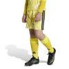 adidas Tiro 26 Competition Goalkeeper Shorts